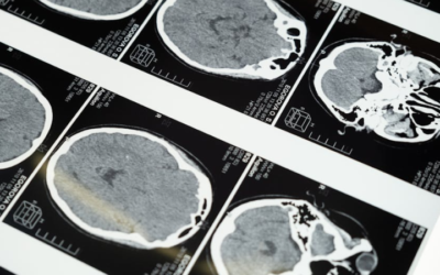 Mózg, który&nbsp;się zmienia: jak medytacja przebudowuje nasz umysł