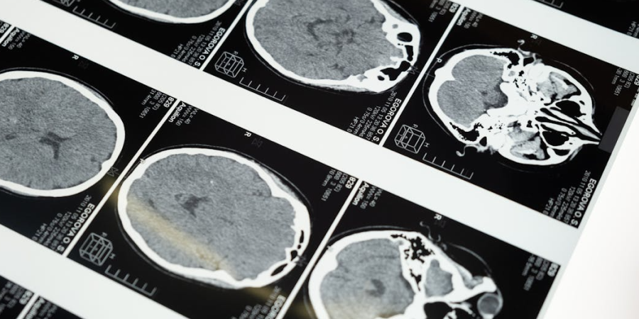 Mózg, który&nbsp;się zmienia: jak medytacja przebudowuje nasz umysł